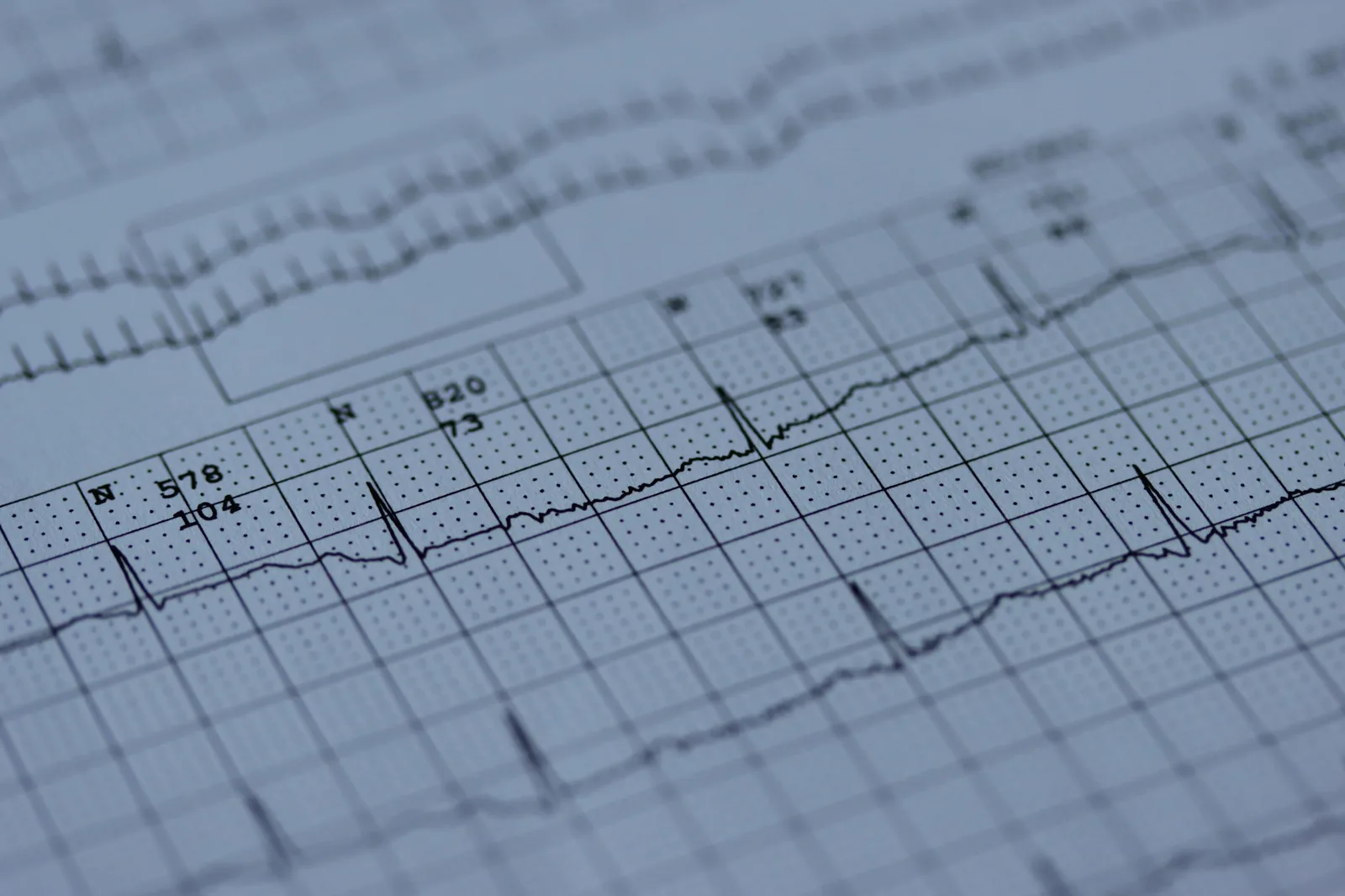 Tracé d'électrocardiogramme imprimé sur papier millimétré